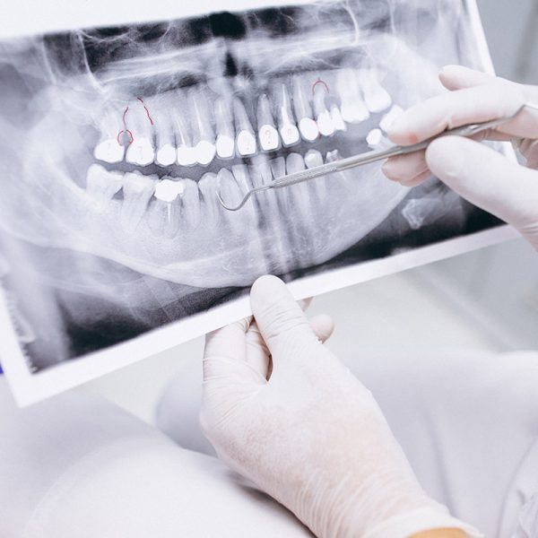 Dentistry and Dental Prosthetics